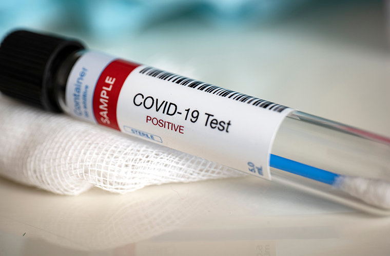 924 COVID-19 Tests Sent From Hopkins County, 249 Pending Results, and 648 Confirmed Negative Per Hopkins County Health District/Hopkins County EMS